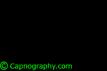 /images/Clinicalapplication/bronch.gif