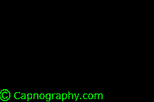 /images/Clinicalapplication/pd1.gif