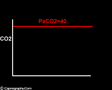 end tidal CO2 and alveolar dead space end tidal CO2 and alveolar dead space