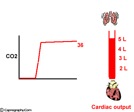 cardiac output and end tidal CO2 cardiac output and end tidal CO2