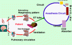 Why Capnography ?