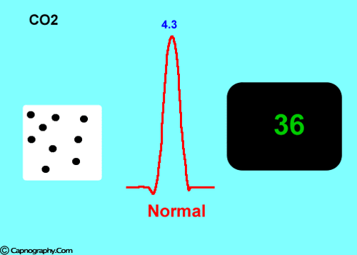 Water vapor absorbs IR light Water vapor absorbs IR light