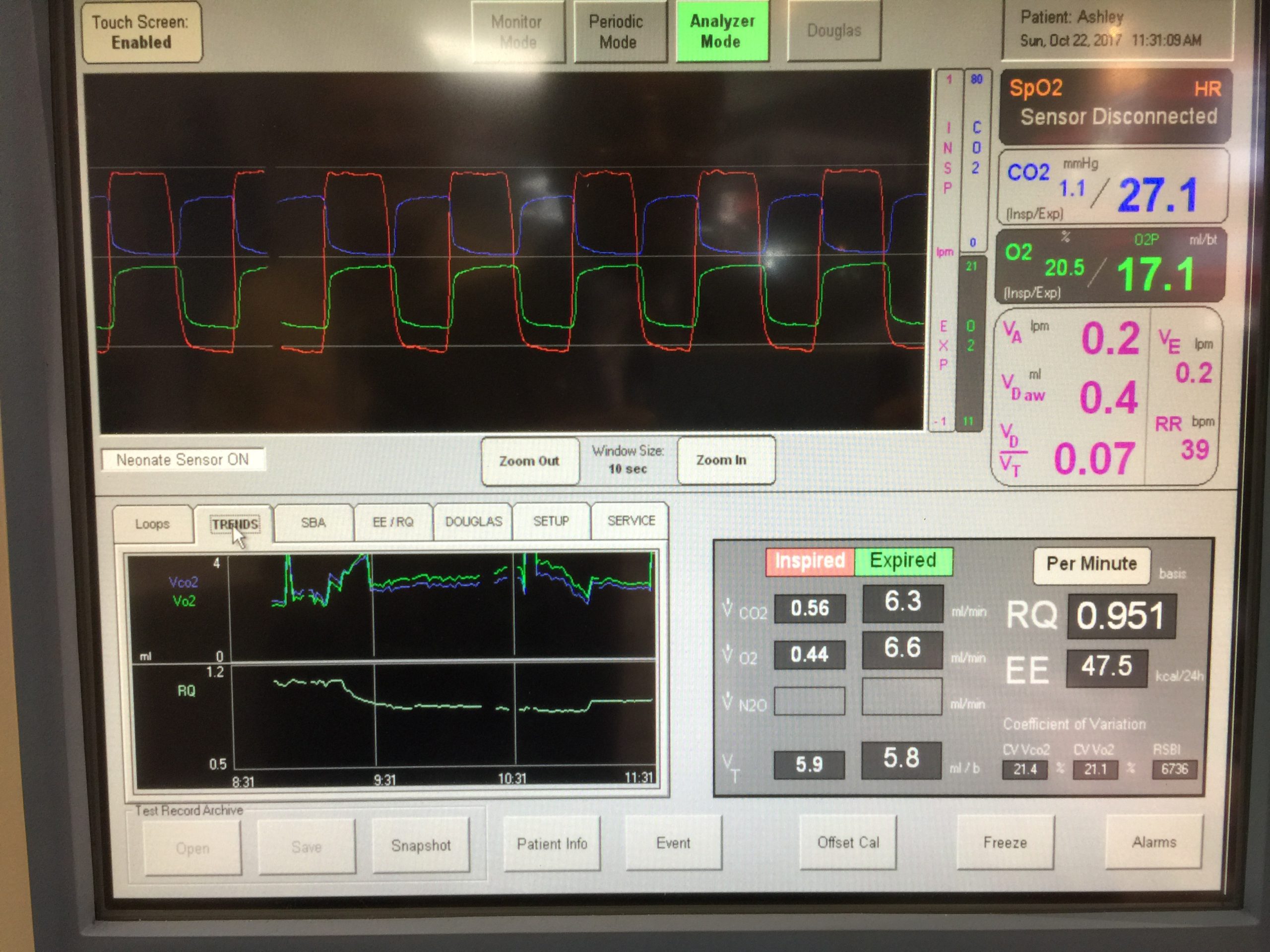 Capnograph new technology in side stream Capnograph new technology in side stream