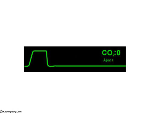 Slide60