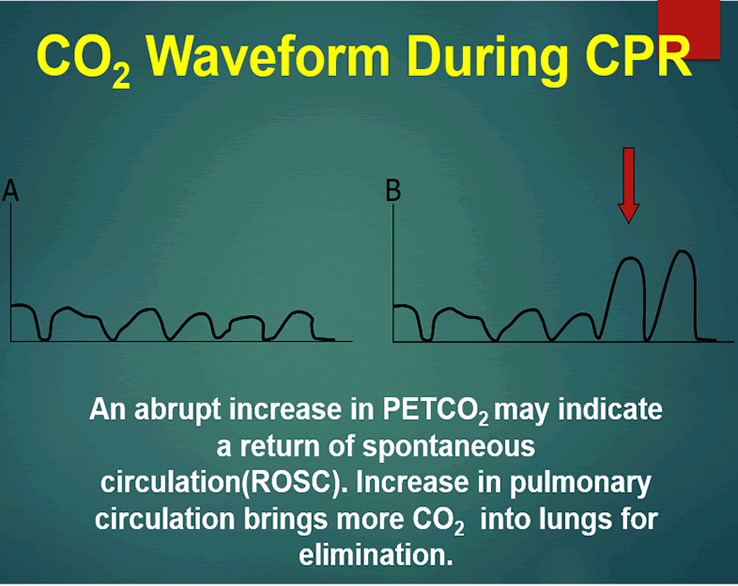 capnograms during CPR