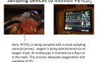 nasal sampling of expired gases with simultaneous oxygen administration