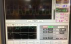 Respiratory flow rates over time capnogram